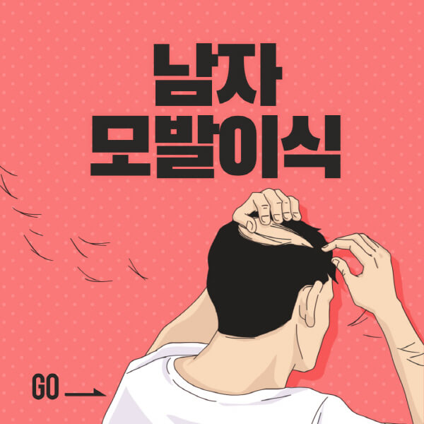 남자-모발이식-후기-비용-전후-부작용-남성-탈모