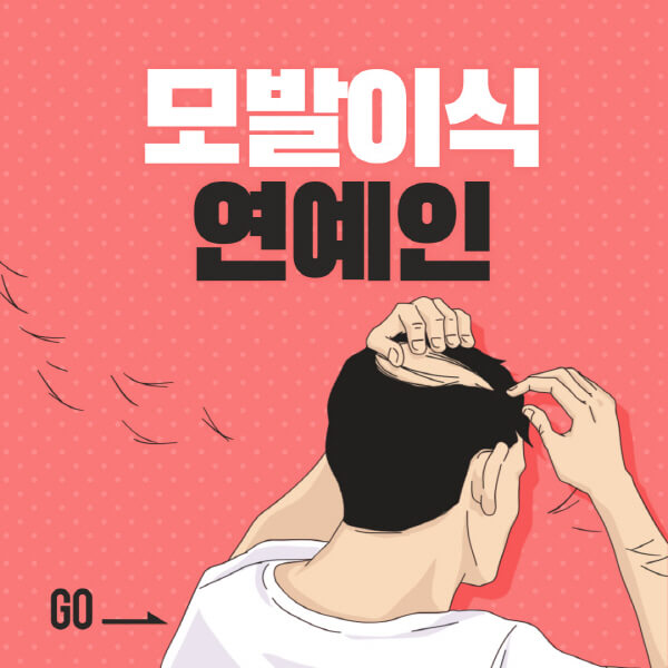 모발이식-연예인-병원-전후-여자