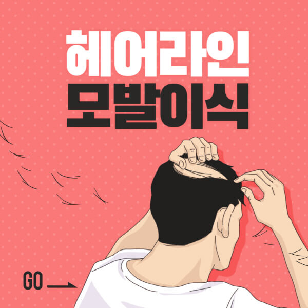 헤어라인-모발이식-비용-가격-후기-부작용-곱슬