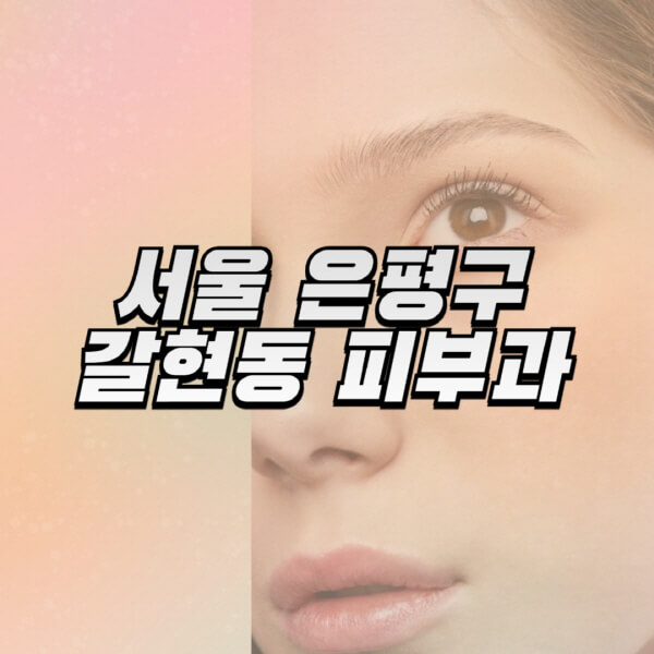 서울-은평구-갈현동-피부과-잘하는-곳-추천-전문의-일요일-진료-유명한-곳-리프팅-보톡스-필러-레이저제모-여드름